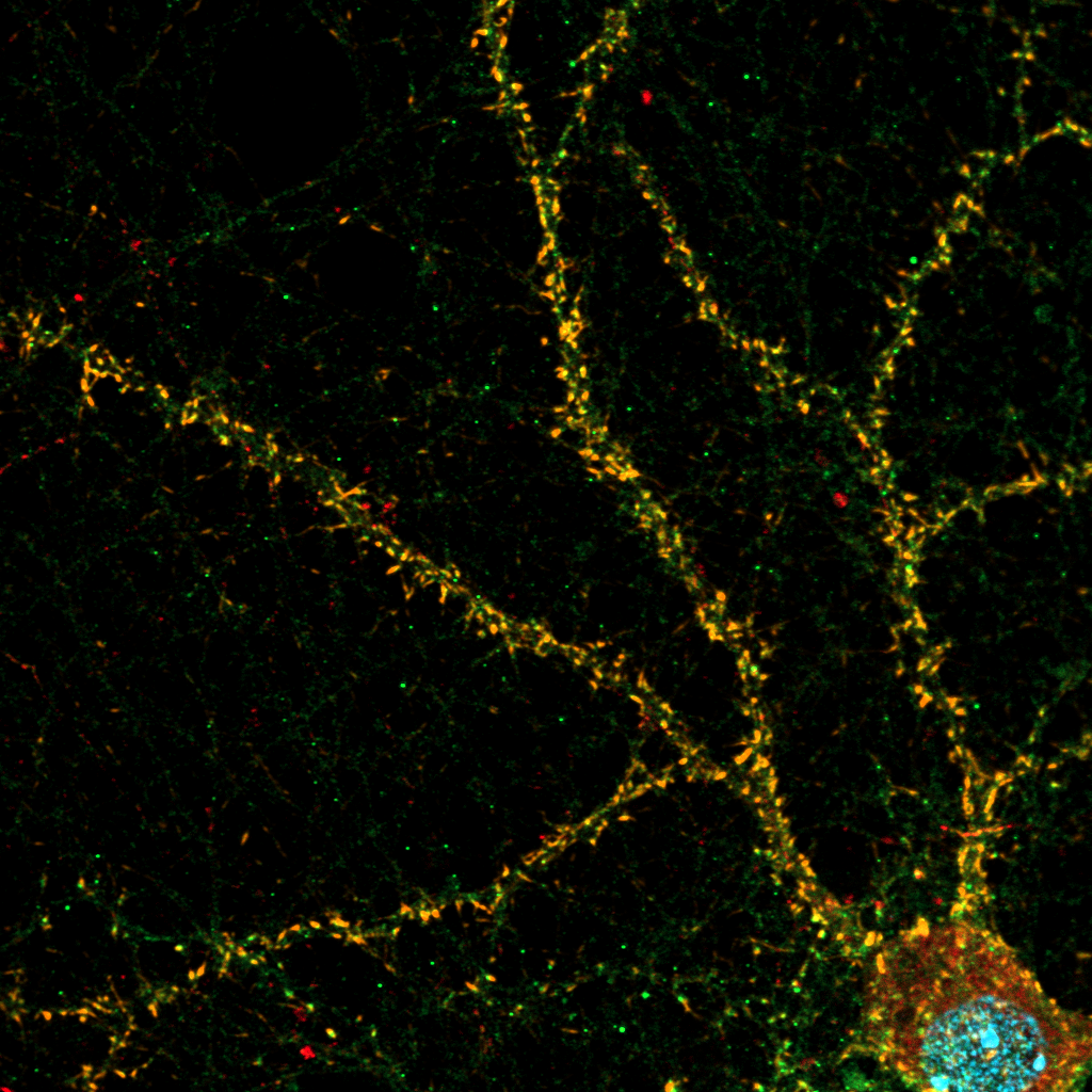 Нейроны, астроциты и ядра